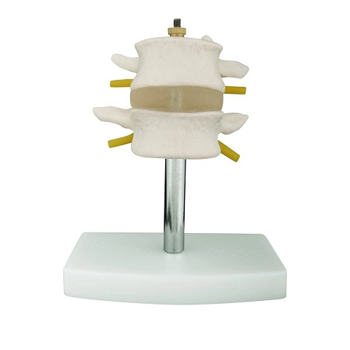 Bộ đốt sống thắt lưng (2 chi tiết) XC-116