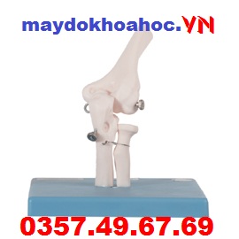 Mô hình khớp xương khuỷu tay GD-A11201-2 Mô hình khớp xương khuỷu tay GD-A11201-2