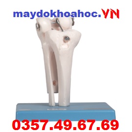 Mô hình khớp gối GD-A11201-5