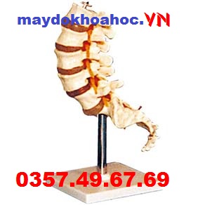 Mô hình đốt sống thắt lưng GD-A11109