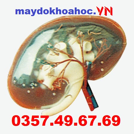  Mô hình phóng đại thận trong suốt GD-A14008