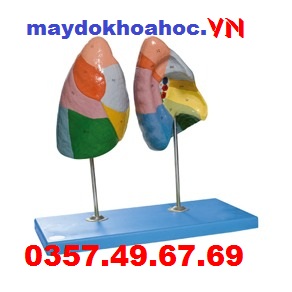 Mô hình phân đoạn phổi GD-A13010