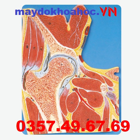 Mô hình mặt cắt khớp hông GD-A11205
